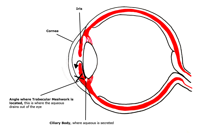 Closed Angle Glaucoma